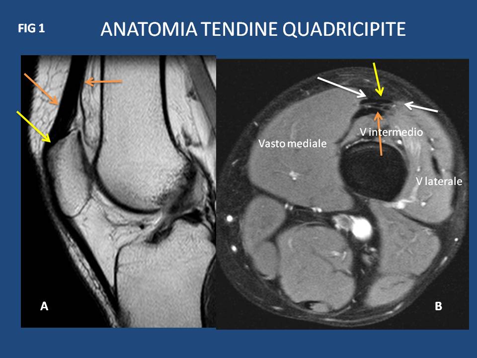 Lesioni tendinee del ginocchio Dottor Sergio De Bac